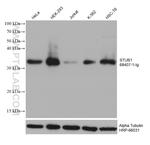 STUB1 Antibody in Western Blot (WB)
