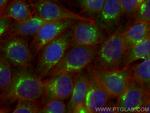 SYAP1 Antibody in Immunocytochemistry (ICC/IF)