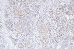 TAP1 Antibody in Immunohistochemistry (Paraffin) (IHC (P))