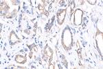 TAP1 Antibody in Immunohistochemistry (Paraffin) (IHC (P))