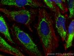 HSDL2 Antibody in Immunocytochemistry (ICC/IF)