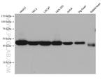 HSDL2 Antibody in Western Blot (WB)