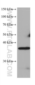 PNMA1 Antibody in Western Blot (WB)