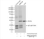 MRPL38 Antibody in Immunoprecipitation (IP)