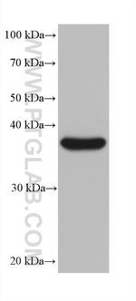 MRPL38 Antibody in Western Blot (WB)