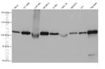 Hexokinase 1 Antibody in Western Blot (WB)