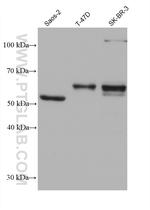 UBOX5 Antibody in Western Blot (WB)
