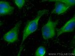 SSSCA1 Antibody in Immunocytochemistry (ICC/IF)
