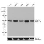 ATP6V1H Antibody in Western Blot (WB)