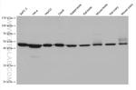 ZNF174 Antibody in Western Blot (WB)