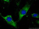 ARP3/ARP3B Antibody in Immunocytochemistry (ICC/IF)