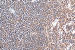 ARP3/ARP3B Antibody in Immunohistochemistry (Paraffin) (IHC (P))
