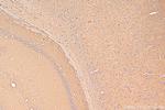 ARP3/ARP3B Antibody in Immunohistochemistry (Paraffin) (IHC (P))