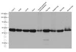 ARP3/ARP3B Antibody in Western Blot (WB)