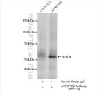 ATP6V1B2 Antibody in Immunoprecipitation (IP)