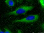 VPS4B Antibody in Immunocytochemistry (ICC/IF)
