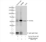 VPS4B Antibody in Immunoprecipitation (IP)