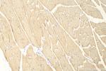 ULK1 Antibody in Immunohistochemistry (Paraffin) (IHC (P))