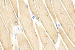 ULK1 Antibody in Immunohistochemistry (Paraffin) (IHC (P))