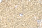 ULK1 Antibody in Immunohistochemistry (Paraffin) (IHC (P))