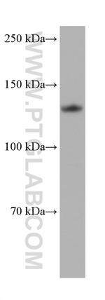 ULK1 Antibody in Western Blot (WB)
