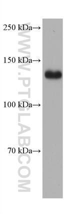 ULK1 Antibody in Western Blot (WB)