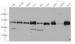 ULK1 Antibody in Western Blot (WB)