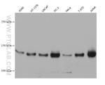 ULK1 Antibody in Western Blot (WB)
