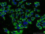 FBP1 Antibody in Immunocytochemistry (ICC/IF)