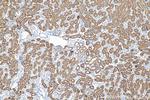 FBP1 Antibody in Immunohistochemistry (Paraffin) (IHC (P))
