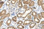 FBP1 Antibody in Immunohistochemistry (Paraffin) (IHC (P))