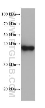 FBP1 Antibody in Western Blot (WB)
