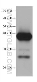 FBP1 Antibody in Western Blot (WB)