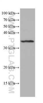 Aquaporin 4 Antibody in Western Blot (WB)