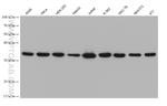 OTUD6B Antibody in Western Blot (WB)
