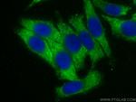 GIMAP7 Antibody in Immunocytochemistry (ICC/IF)