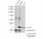 GIMAP7 Antibody in Immunoprecipitation (IP)