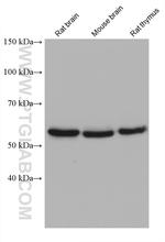 CAMK4 Antibody in Western Blot (WB)