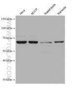 DDX43 Antibody in Western Blot (WB)