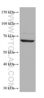DDX43 Antibody in Western Blot (WB)
