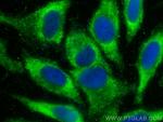 SQRDL Antibody in Immunocytochemistry (ICC/IF)