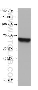 IGF2BP3 Antibody in Western Blot (WB)