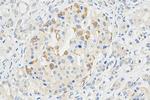 MAOA Antibody in Immunohistochemistry (Paraffin) (IHC (P))