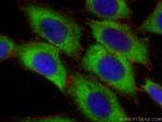 EIF2S1 Antibody in Immunocytochemistry (ICC/IF)