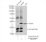EIF2S1 Antibody in Immunoprecipitation (IP)