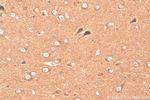 UNC13A Antibody in Immunohistochemistry (Paraffin) (IHC (P))