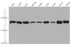 DNMT1 Antibody in Western Blot (WB)