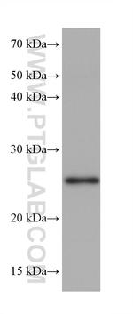 NQO2 Antibody in Western Blot (WB)