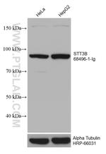 STT3B Antibody in Western Blot (WB)