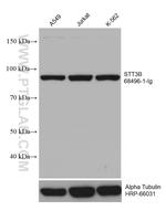 STT3B Antibody in Western Blot (WB)